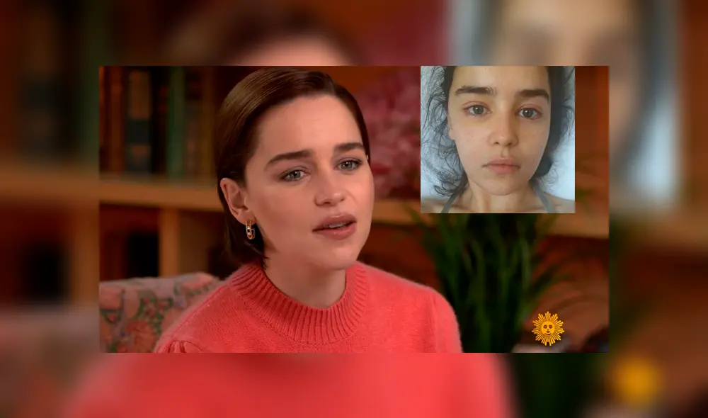 Emilia Clarke comparte fotos de su postoperación por aneurisma cerebral