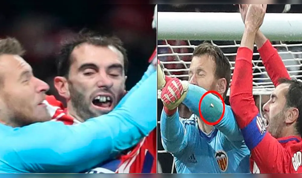 Así quedó Diego Godín tras perder tres dientes en pleno encuentro [FOTO]