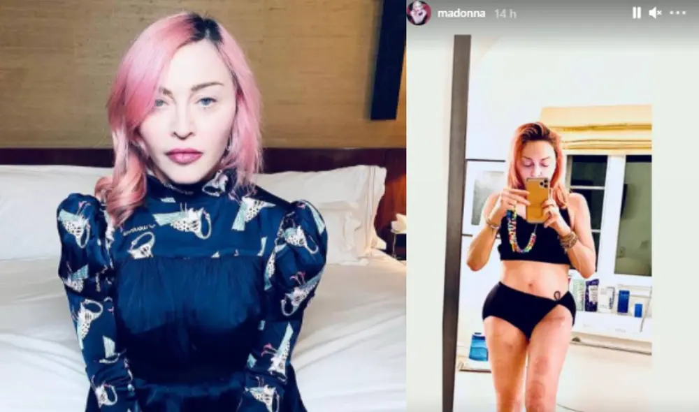 Madonna tuvo un año muy complicado por problemas en su salud.