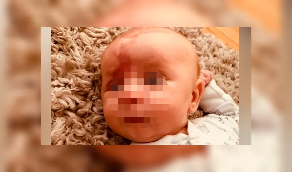 Oscar ha sufrido de 10 convulsiones en solo una semana tras la detección del síndrome (Captura: The Mirror) Oscar ha sufrido de 10 convulsiones en solo una semana tras la detección del síndrome (Captura: The Mirror)