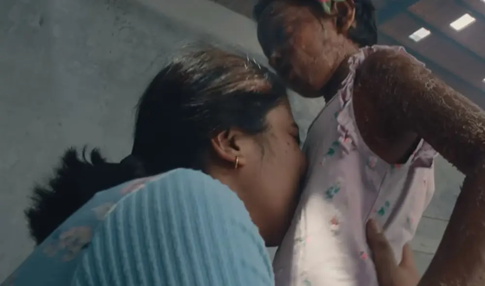 Nisha sufre de una de las afecciones cutáneas más raras del mundo. Foto: Captura.