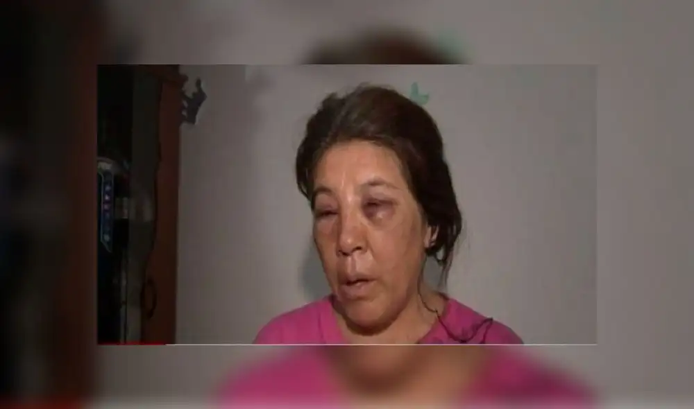 VMT: Mototaxista que desfiguró rostro a su ex pareja podría salir libre [VIDEO]