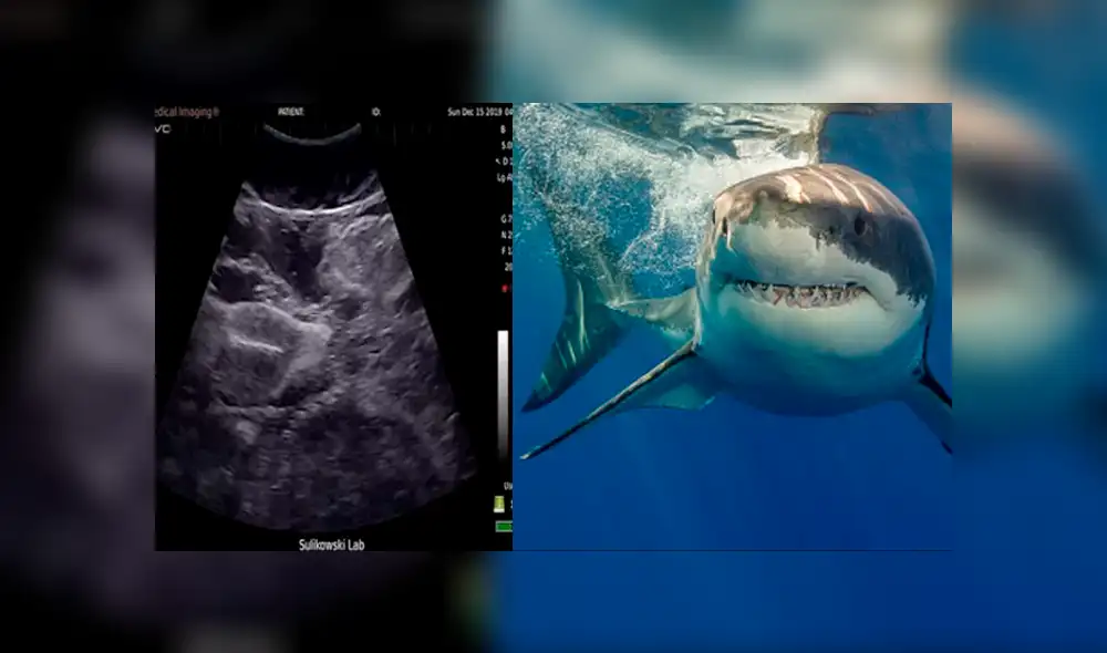 Video es viral en Facebook. Impactantes imágenes muestran el ultrasonido de un tiburón tigre retorciéndose en el útero de su madre Video es viral en Facebook. Impactantes imágenes muestran el ultrasonido de un tiburón tigre retorciéndose en el útero de su madre