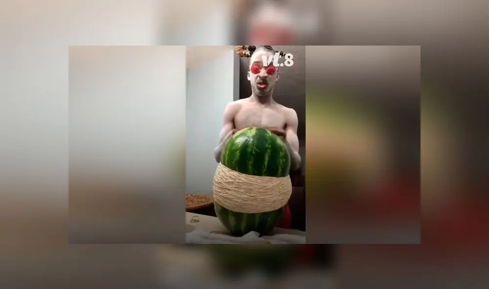 Desliza las imágenes para ver el terrible resultado que obtuvo un joven al hacer un experimento casero. Foto: VT Desliza las imágenes para ver el terrible resultado que obtuvo un joven al hacer un experimento casero. Foto: VT