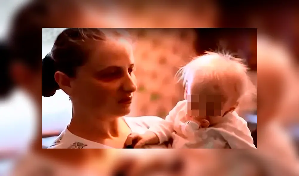 La muerte de Anna Sakidon, una niña ucraniana de 8 años diagnosticada con el síndrome de progeria Hutchinson-Gilford, ha conmovido a todos. (Foto: Difusión) La muerte de Anna Sakidon, una niña ucraniana de 8 años diagnosticada con el síndrome de progeria Hutchinson-Gilford, ha conmovido a todos. (Foto: Difusión)