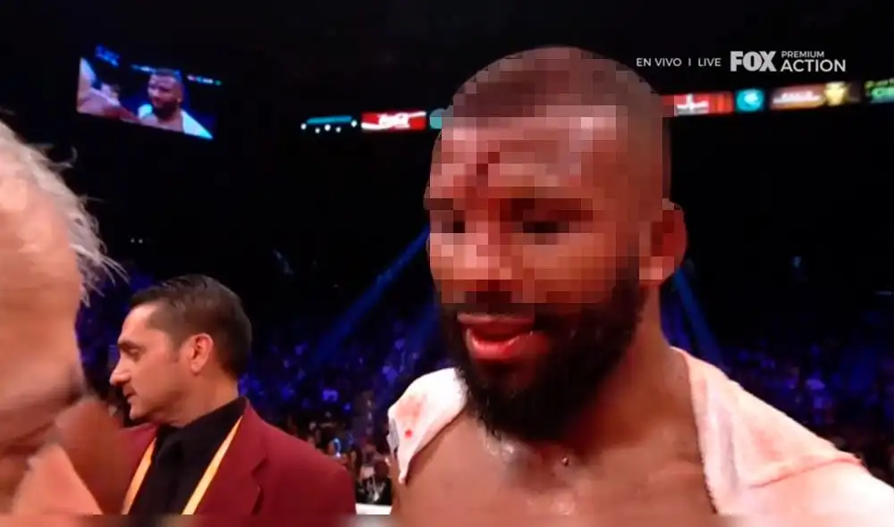 Pacquiao vs Broner: El espeluznante corte en la frente de Badou Jack [FOTO]