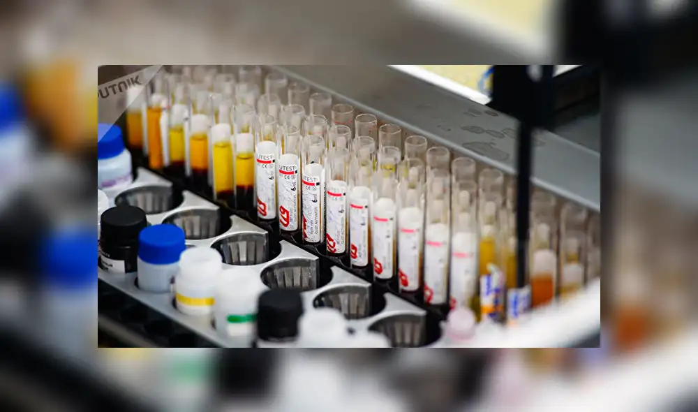 La fascitis necrotizante puede ser causada por diferentes tipos de bacterias, como Strep o Vibrio vulnificus del Grupo A. Foto: Difusión La fascitis necrotizante puede ser causada por diferentes tipos de bacterias, como Strep o Vibrio vulnificus del Grupo A. Foto: Difusión