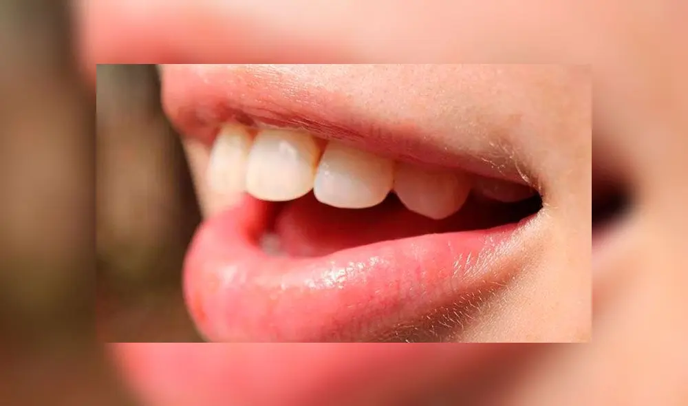 Cinco días después de tener sexo, el hombre se percató de un punto negro en su pene.