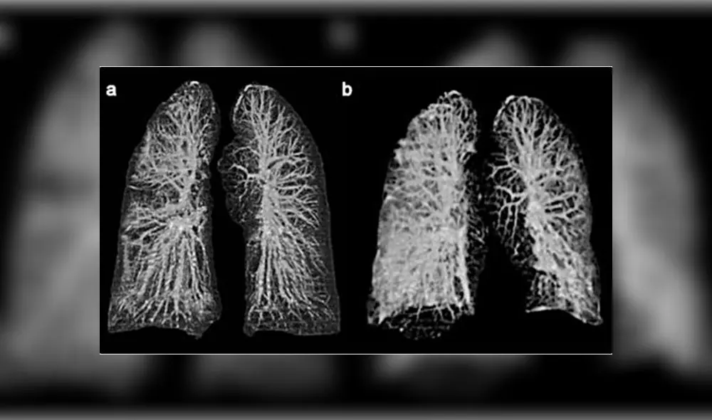 Coronavirus pacientes Coronavirus pacientes