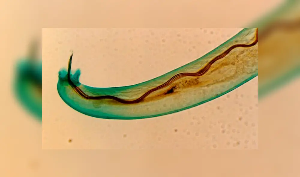 La enfermedad es conocida como angiostrongiliasis. Foto: Difusión