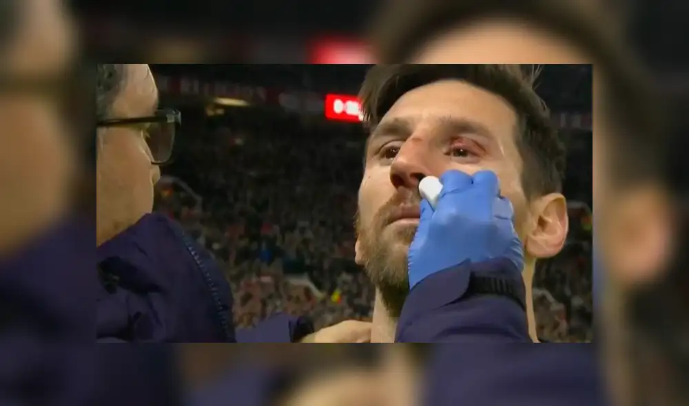 Barcelona vs Manchester United: Messi sufrió espeluznante corte tras duro choque