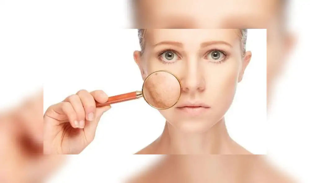 Lunares sospechosos Lunares sospechosos