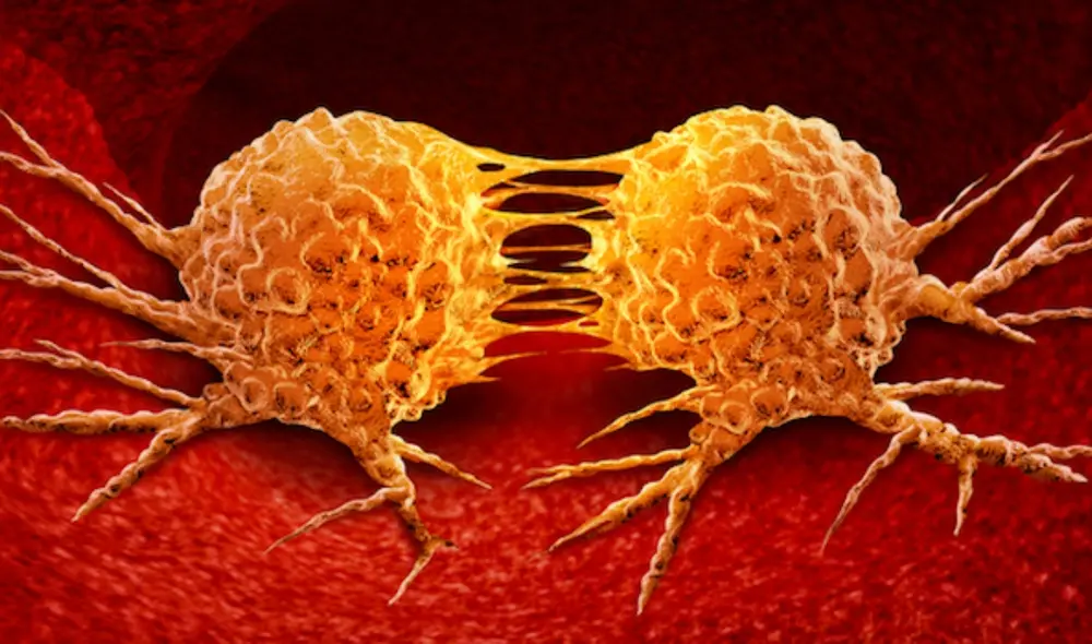 El trabajo abre la vía a desarrollar nuevos enfoques terapéuticos y herramientas diagnósticas para frenar la progresión del cáncer de colon. Foto: Vanderbilt University