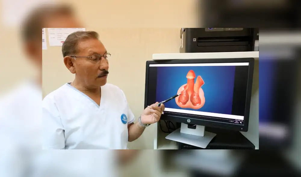 Médicos de EsSalud realizan la primera cirugía de reconstrucción de pene. Foto: Andina