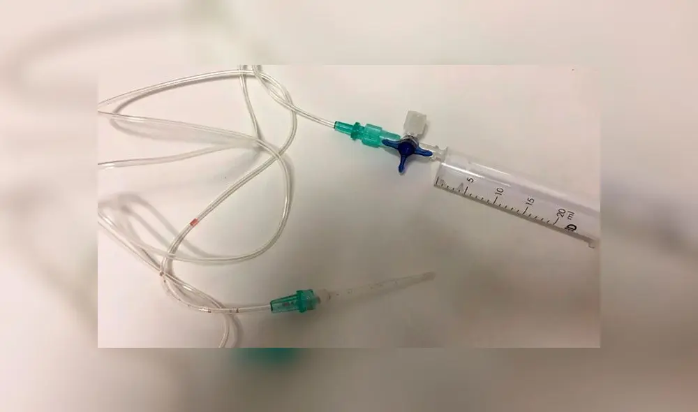 Lengua de un niño se atora en una botella tras intentar tomar la última gota de su jugo [FOTOS]