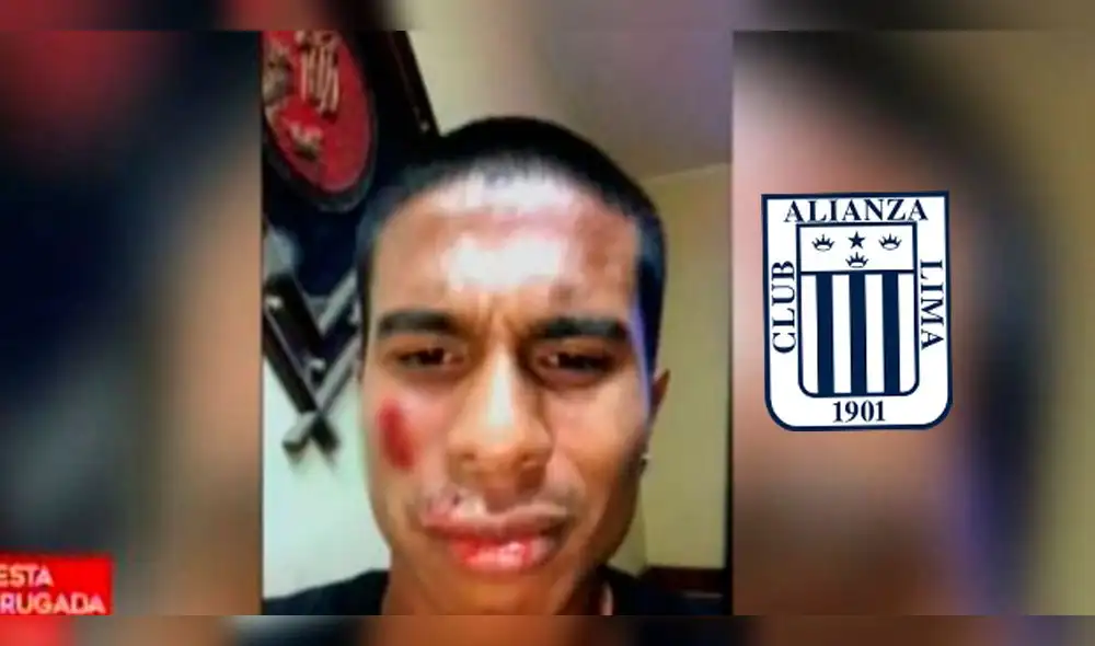 Alianza Lima se pronuncia sobre la salvaje agresión contra José Marina Alianza Lima se pronuncia sobre la salvaje agresión contra José Marina