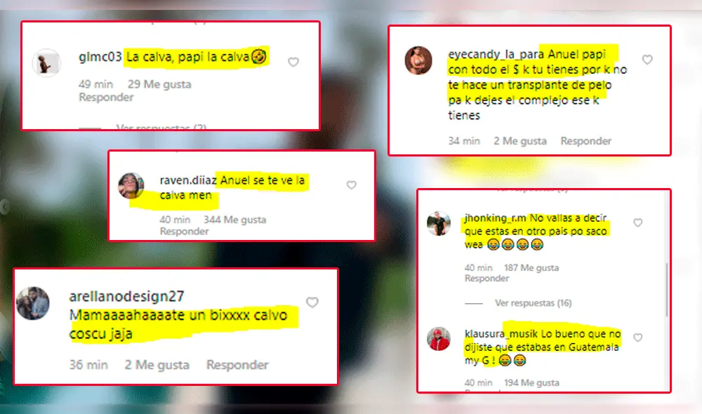 Anuel AA expone calvicie a fans tras 'accidente' en Instagram [VIDEO]