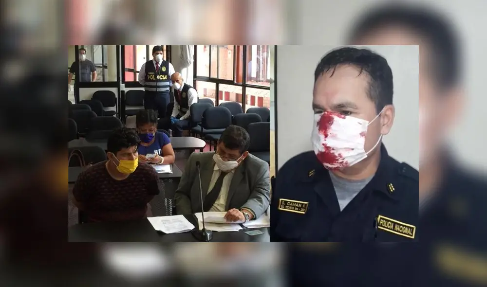 Investigado podría afrontar una pena de hasta 12 de cárcel por causar lesiones a un policía durante el cumplimiento de sus funciones. (Foto: Corte de Justicia de Lima Norte) Investigado podría afrontar una pena de hasta 12 de cárcel por causar lesiones a un policía durante el cumplimiento de sus funciones. (Foto: Corte de Justicia de Lima Norte)