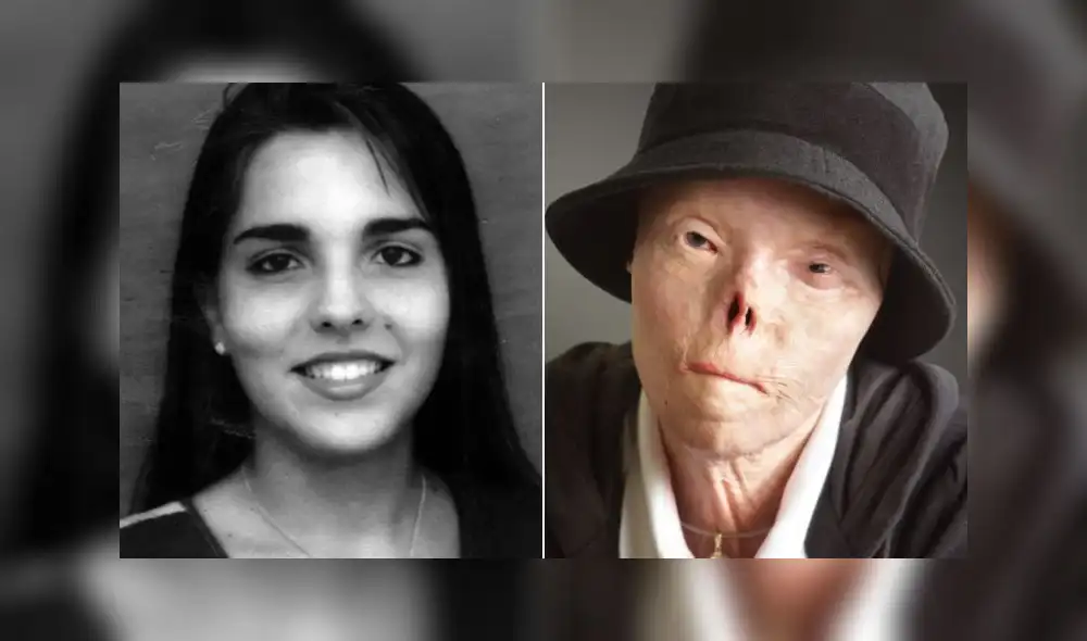 Muere Jacqui Saburido, símbolo de la campaña “Los rostros de conducir ebrio”