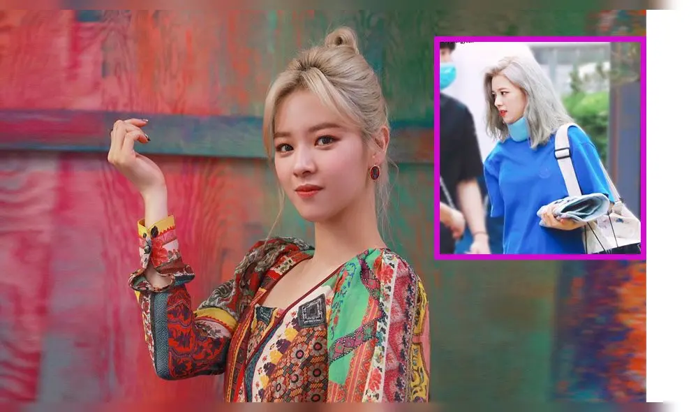 Jeongyeon de TWICE sufrió lesión en el cuello.