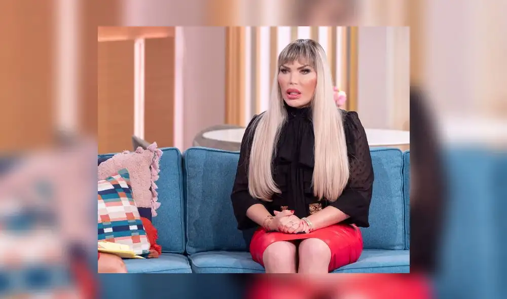 Rodrigo Alves, ahora una celebridad trans, se sometió a una cirugía de feminización facial. Foto: Captura. Rodrigo Alves, ahora una celebridad trans, se sometió a una cirugía de feminización facial. Foto: Captura.