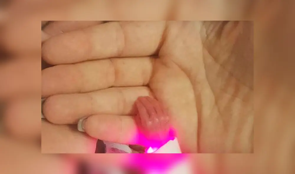 La madre de la pequeña fue inducida a una cesárea luego de presentar diversas complicaciones durante el embarazo. (Captura: 20 Minutos) La madre de la pequeña fue inducida a una cesárea luego de presentar diversas complicaciones durante el embarazo. (Captura: 20 Minutos)