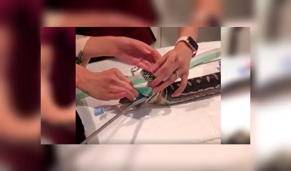 Desliza las imágenes para observar la valiente acción de un grupo de veterinarios para sacar una toalla del estómago de una pitón.