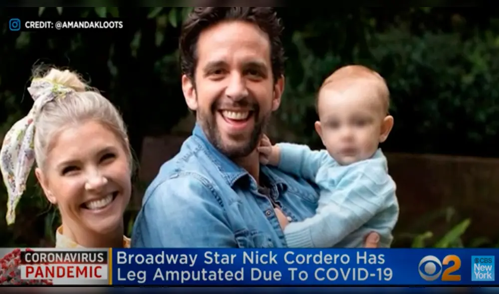 Nick Cordero, actor de Brodway, sufre la amputación de una pierna por el coronavirus Nick Cordero, actor de Brodway, sufre la amputación de una pierna por el coronavirus