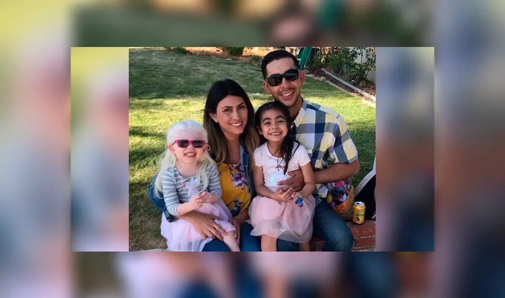 Hombre duda sobre la paternidad de su hija y descubre que la menor era albina Hombre duda sobre la paternidad de su hija y descubre que la menor era albina