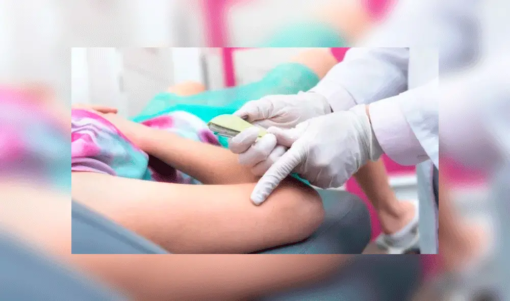 Implantes subdérmicos Implantes subdérmicos