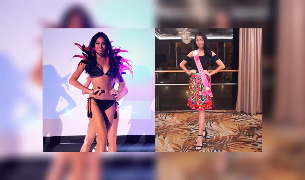 Candidata panameña asegura que fue expulsada de un concurso de belleza por vitiligo [VIDEO]