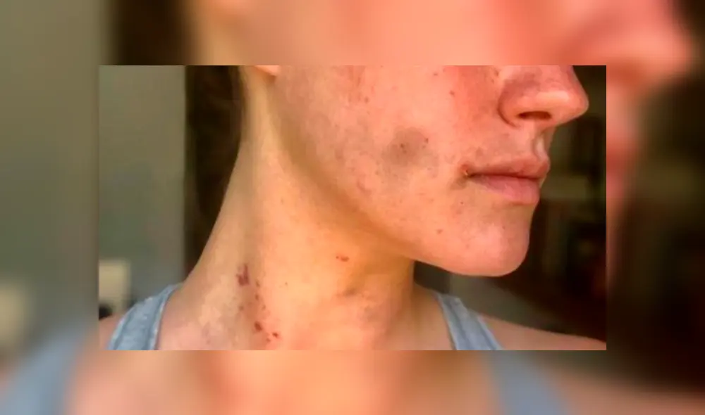 Acusan al nieto de Rogerio Azcárraga de golpear a una mujer [FOTOS]