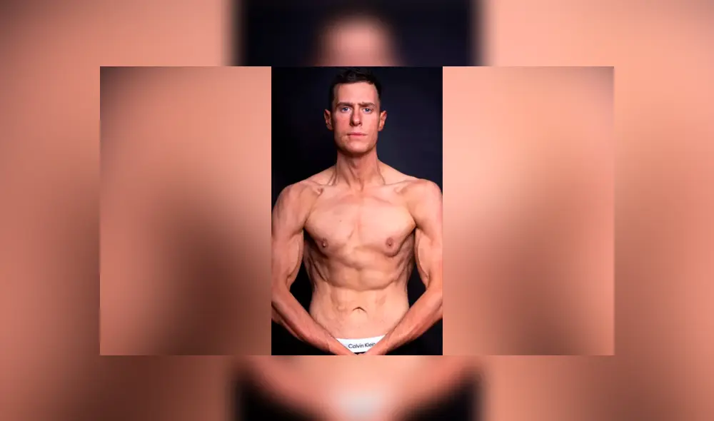 Su médico le dijo que el hombre más "desafortunado del mundo", pero él no se dio por vencido y cambio su estilo de vida. Foto: captura. Su médico le dijo que el hombre más "desafortunado del mundo", pero él no se dio por vencido y cambio su estilo de vida. Foto: captura.