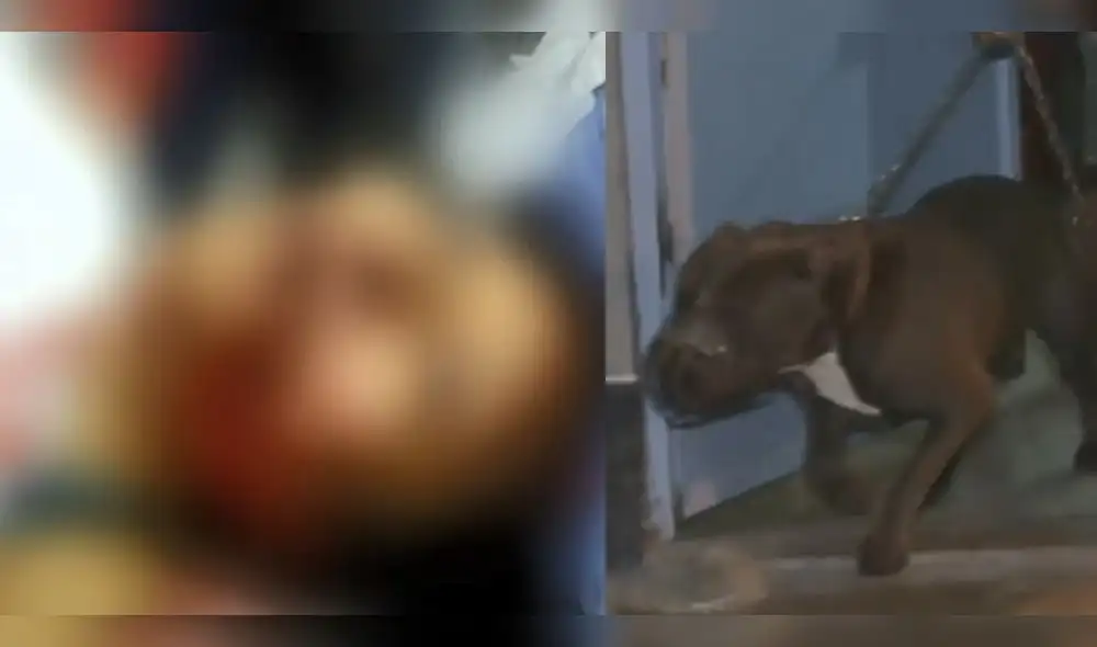 SJM: Mujer se debate entre la vida y la muerte tras salvaje ataque de grupo de pitbulls