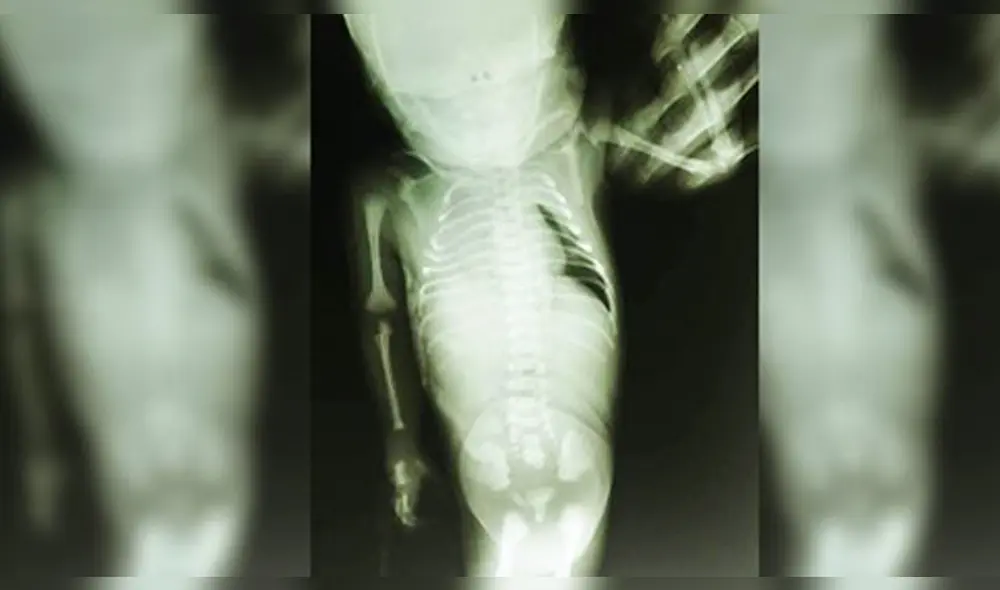 La bebé nació con muchas complicaciones. La bebé nació con muchas complicaciones.