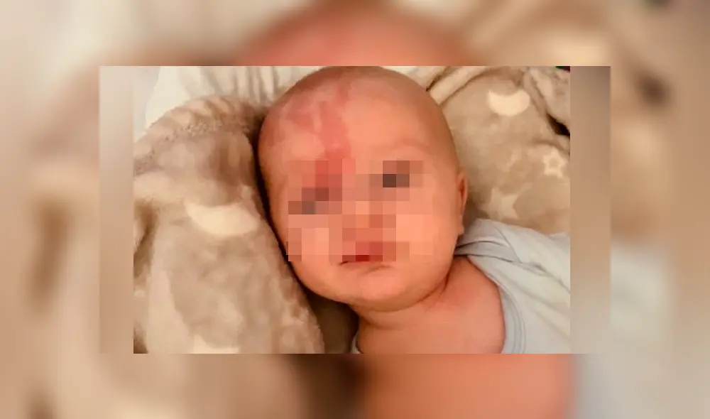 Oscar ha sufrido de 10 convulsiones en solo una semana tras la detección del síndrome (Captura: The Mirror) Oscar ha sufrido de 10 convulsiones en solo una semana tras la detección del síndrome (Captura: The Mirror)