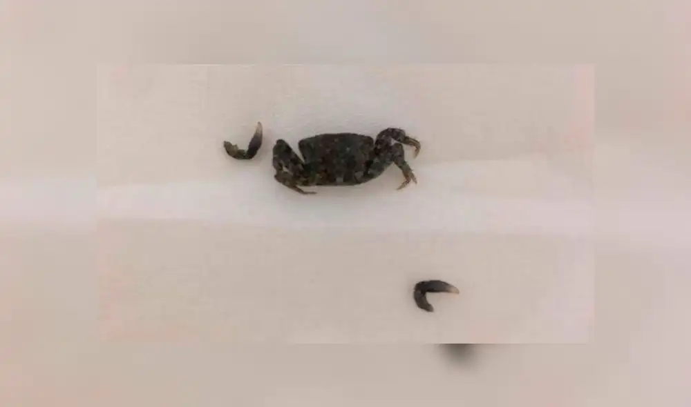 El animal fue retirado con un endoscopio. Fuente: Gulf News. El animal fue retirado con un endoscopio. Fuente: Gulf News.