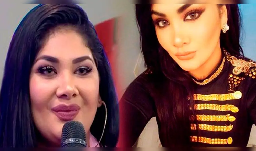 Antes y después de los famosos que se hicieron la cirugía del bypass gástrico