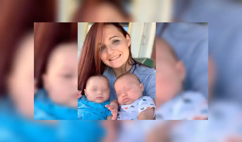 Bebé con herpes Bebé con herpes