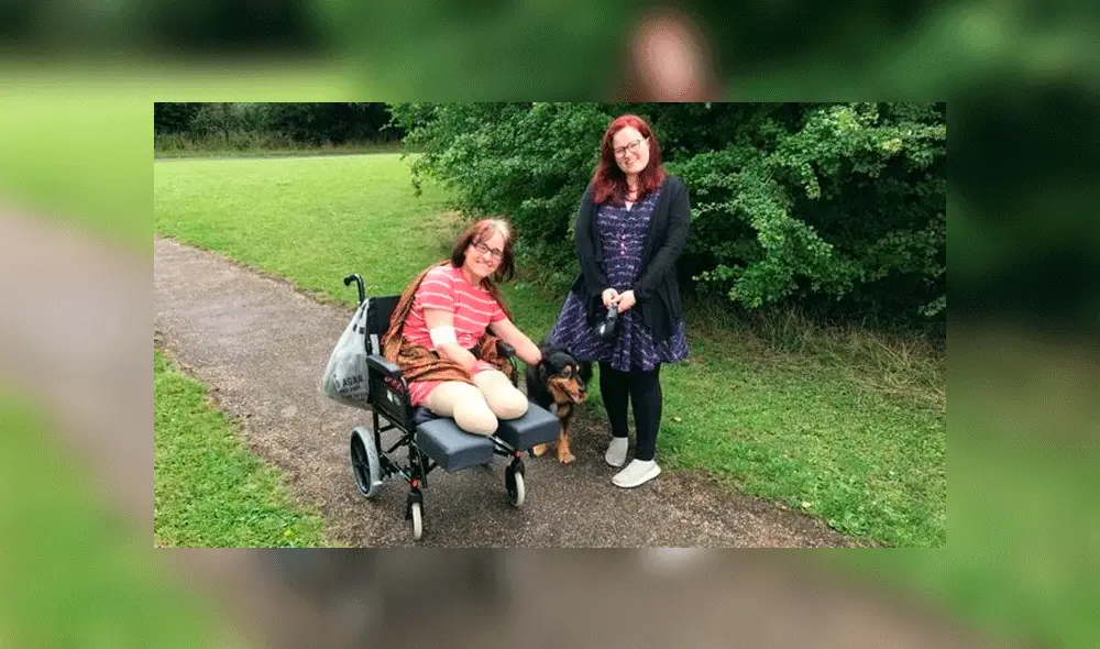Caroline Coster trata de adaptarse a su nueva vida sin extremidades. Foto: BBC. Caroline Coster trata de adaptarse a su nueva vida sin extremidades. Foto: BBC.