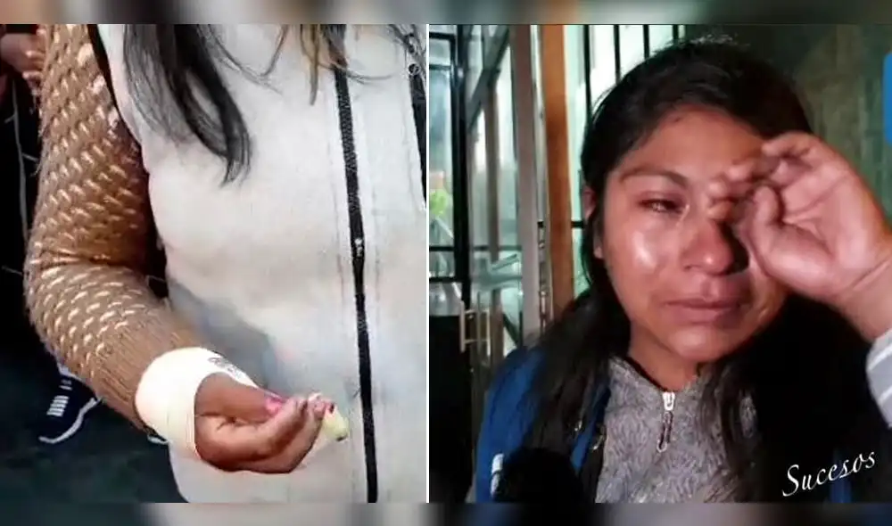 Comerciante resulta con grave quemadura tras operativo de policías municipales en Arequipa Comerciante resulta con grave quemadura tras operativo de policías municipales en Arequipa