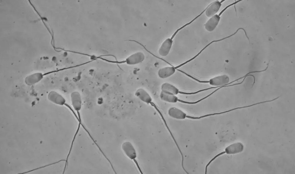 Espermatozoides bajo un microscopio. Foto: University of Wisconsin Espermatozoides bajo un microscopio. Foto: University of Wisconsin