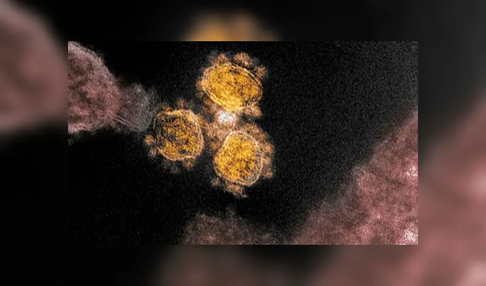 Imagen de microscopio electrónico muestra al coronavirus que causa COVID-19. Fuente: NIAID.