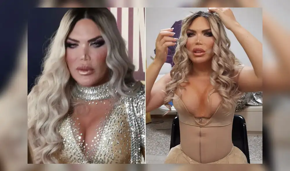Rodrigo Alves, ahora una celebridad trans, se sometió a una cirugía de feminización facial. Foto: Captura. Rodrigo Alves, ahora una celebridad trans, se sometió a una cirugía de feminización facial. Foto: Captura.