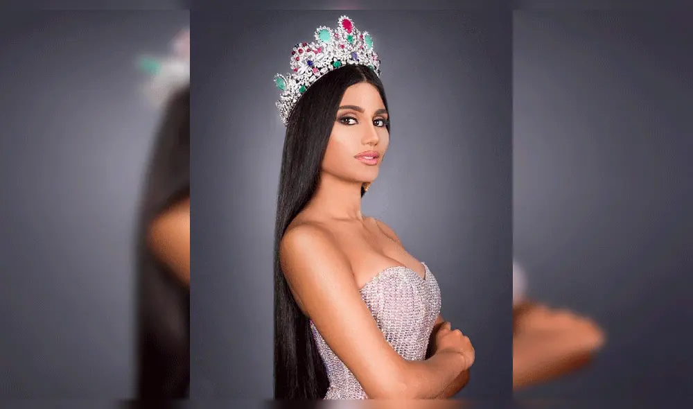 Filtran inéditas imágenes de Miss Venezuela antes de operaciones en el rostro