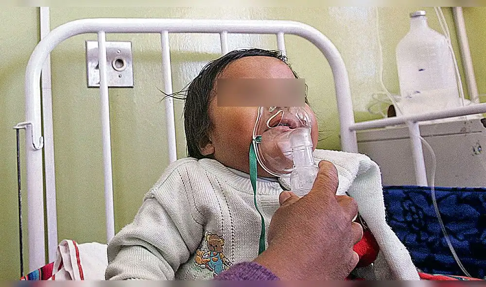 Neumonía cobró la vida de 25 personas en lo que va del año en región Piura