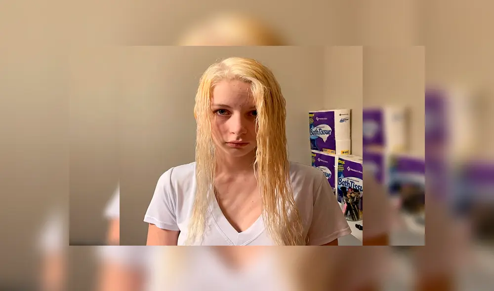 Facebook: Así quedó una joven que intentó decolorarse el cabello con lejía [FOTOS]