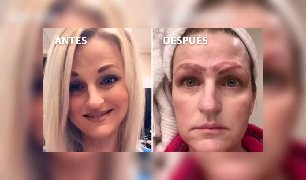 Facebook viral: así quedó una mujer que se sometió a un tratamiento de tatuaje de cejas [VIDEO]