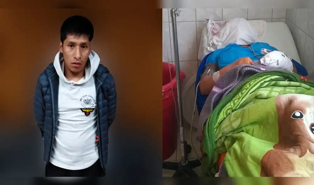 Hombre atacó con un cuchillo a su conviviente en Majes. Hombre atacó con un cuchillo a su conviviente en Majes.