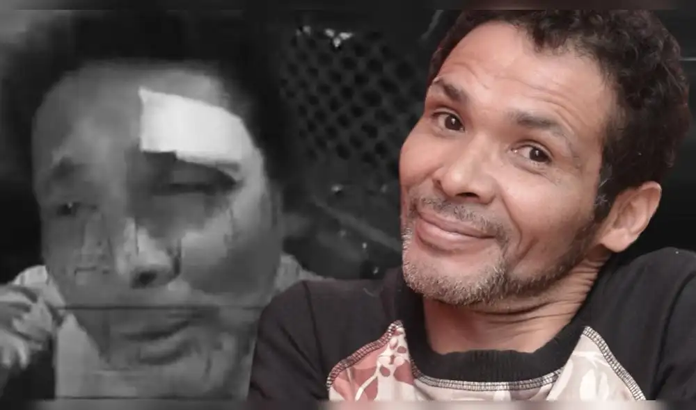 Kike Suero pelea con detenido en comisaría y termina con la ceja rota Kike Suero pelea con detenido en comisaría y termina con la ceja rota